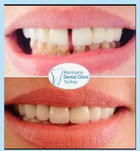 Dt. Şule Dülger smile gallery