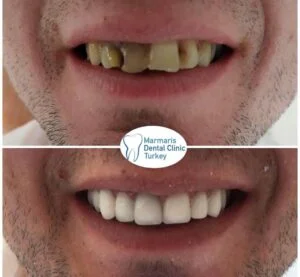 Dt. Şule Dülger smile gallery
