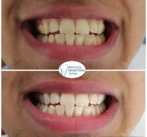 Dt. Şule Dülger smile gallery