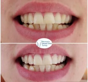 Dt. Şule Dülger smile gallery