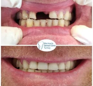Dt. Şule Dülger smile gallery