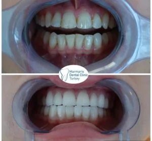 Dt. Şule Dülger smile gallery