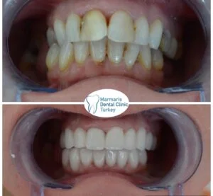 Dt. Şule Dülger smile gallery