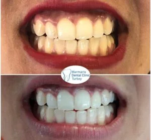 Dt. Şule Dülger smile gallery