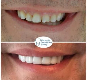 Dt. Şule Dülger smile gallery