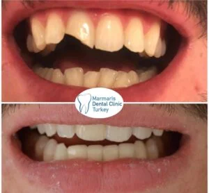 Dt. Şule Dülger smile gallery