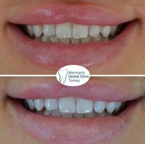 Dt. Şule Dülger smile gallery
