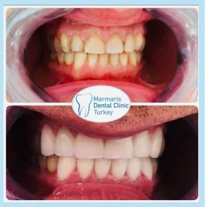 Dt. Şule Dülger smile gallery