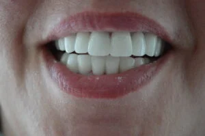 Dt. Şule Dülger smile gallery