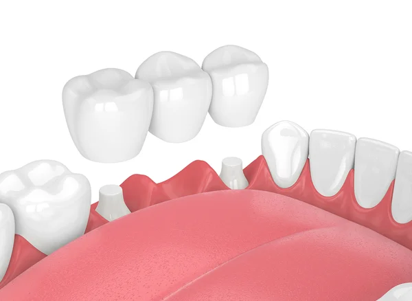 Dental treatment image
