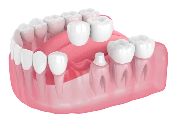 Dental treatment image