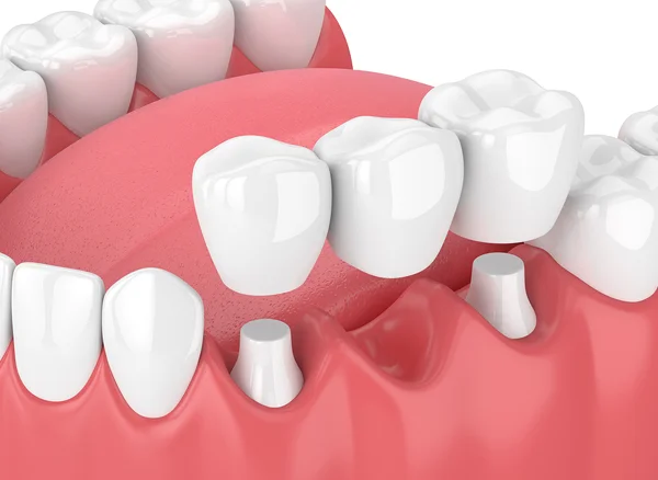 Dental treatment image