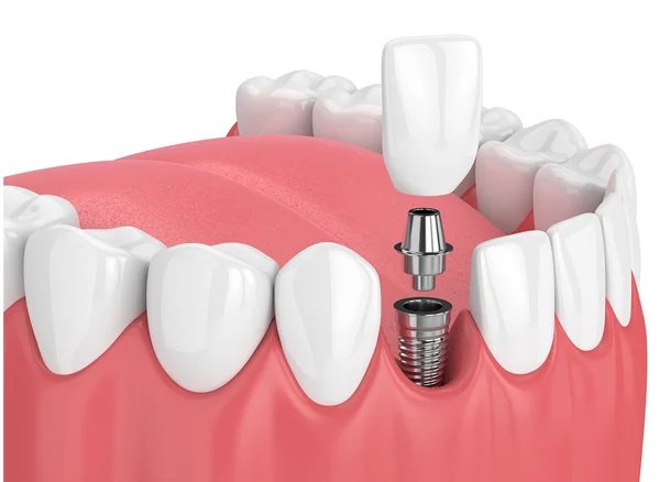 Dental treatment image