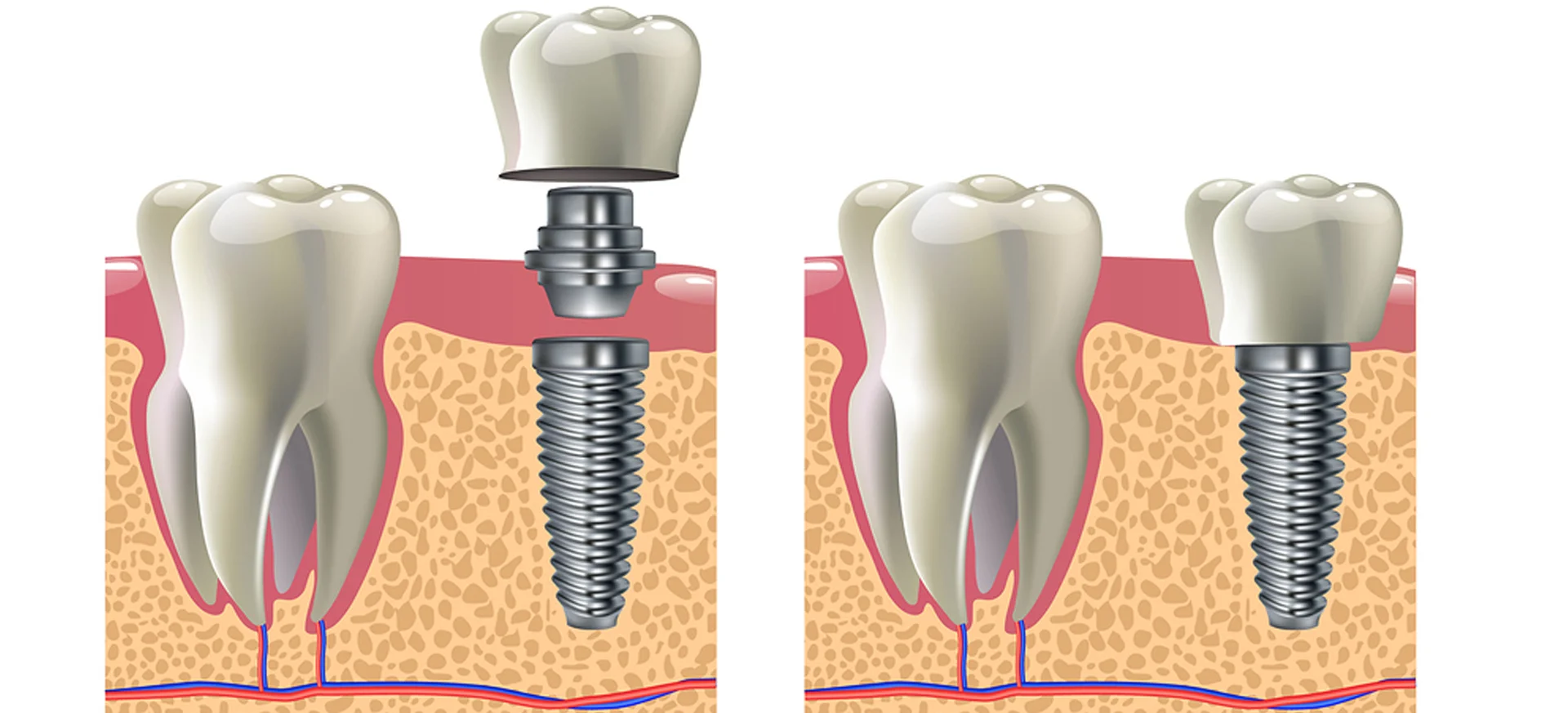 Dental treatment image