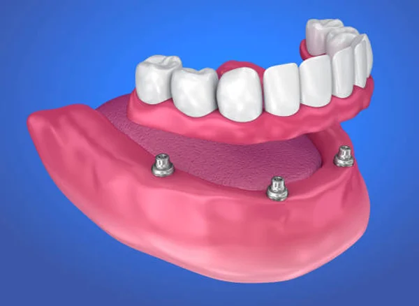 Dental treatment image