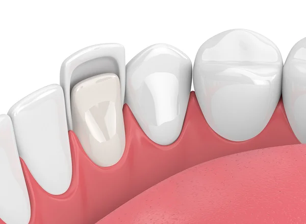 Dental treatment image