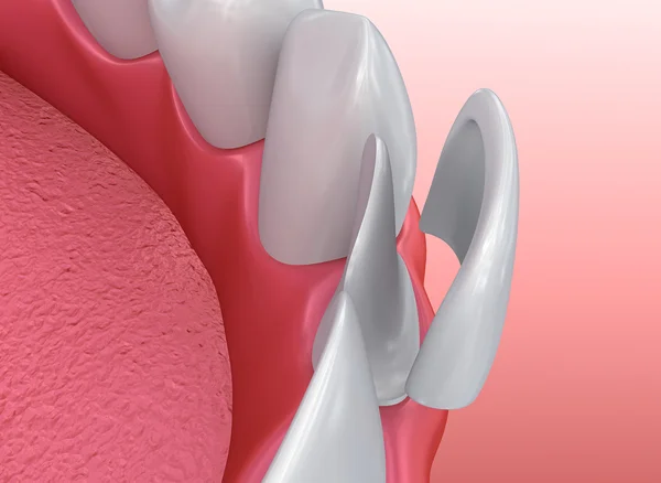 Dental treatment image