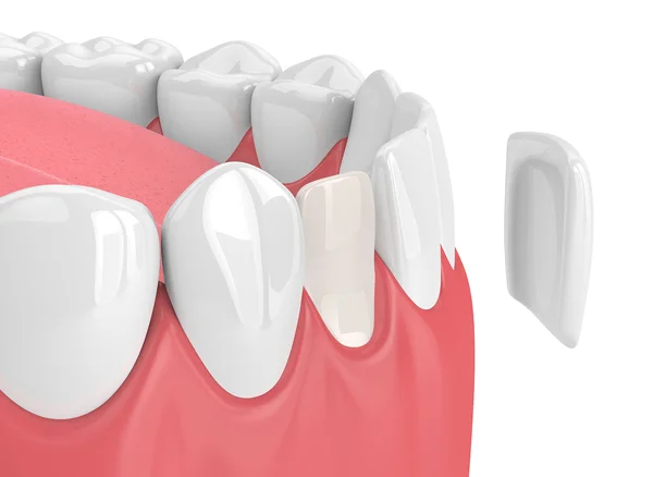 Dental treatment image